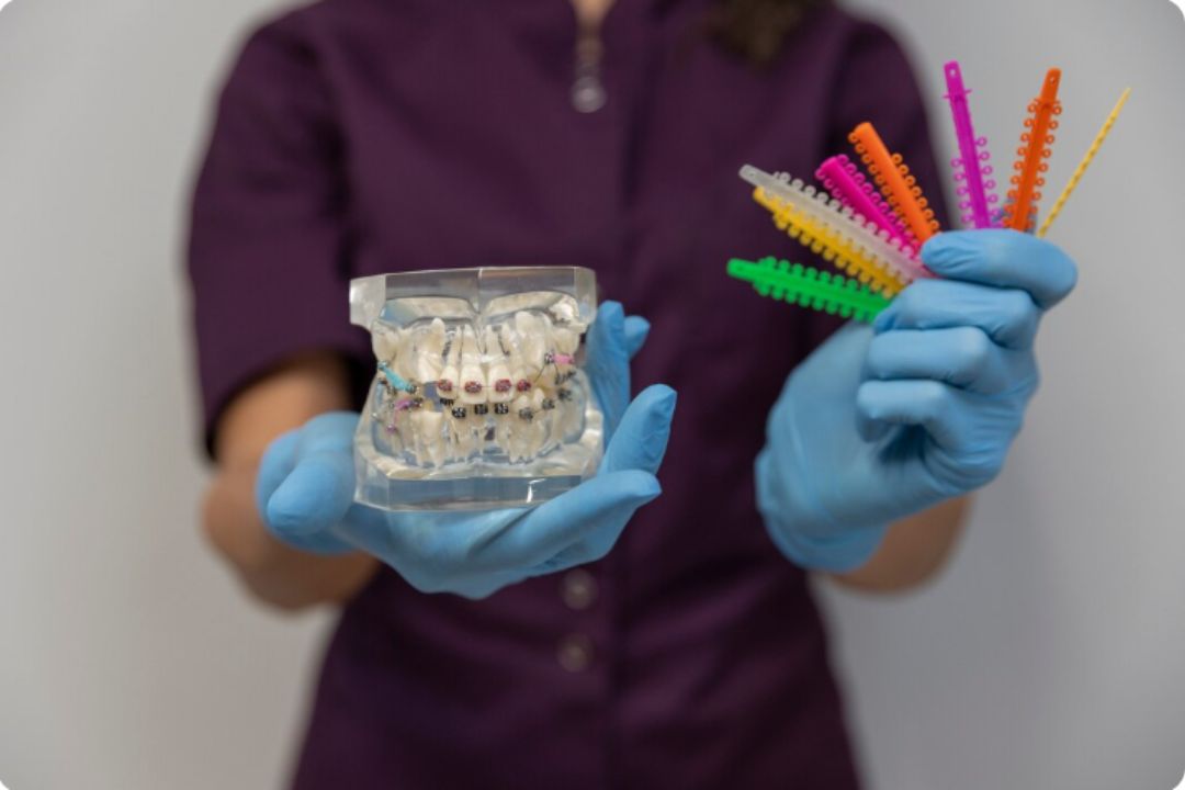 types of dental braces metal ceramic lingual and invisible